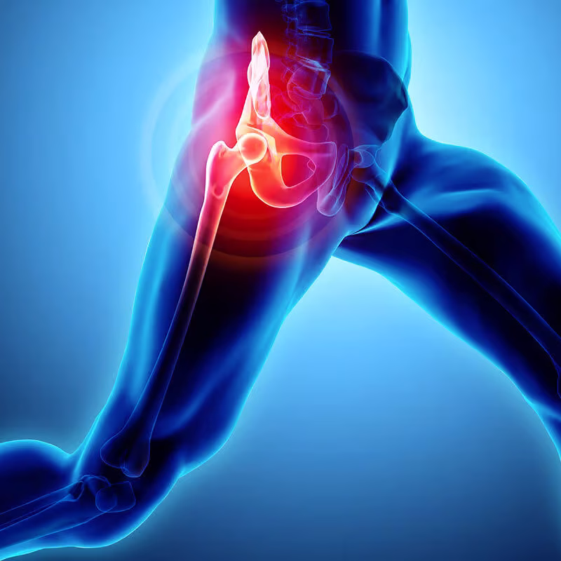 What-You-Should-Know-About-Hip-Pain